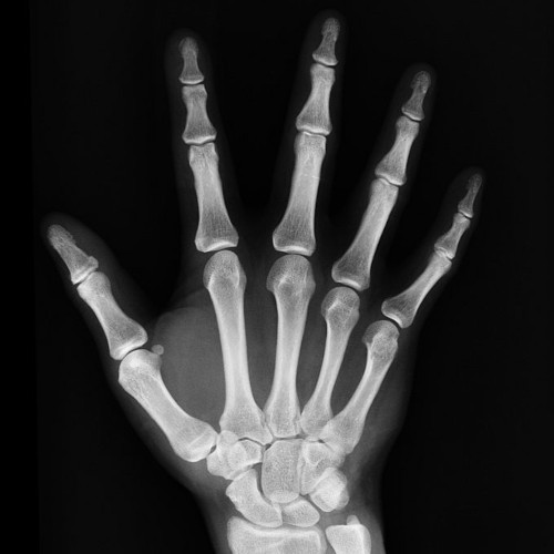 Image Radiographie générale image
