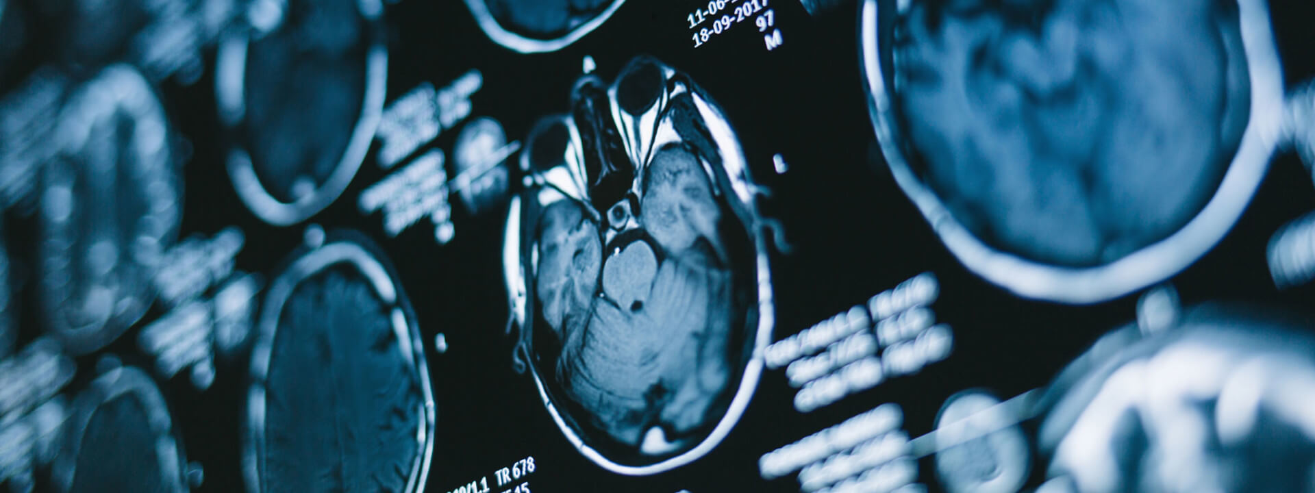 Image IRM du cerveau